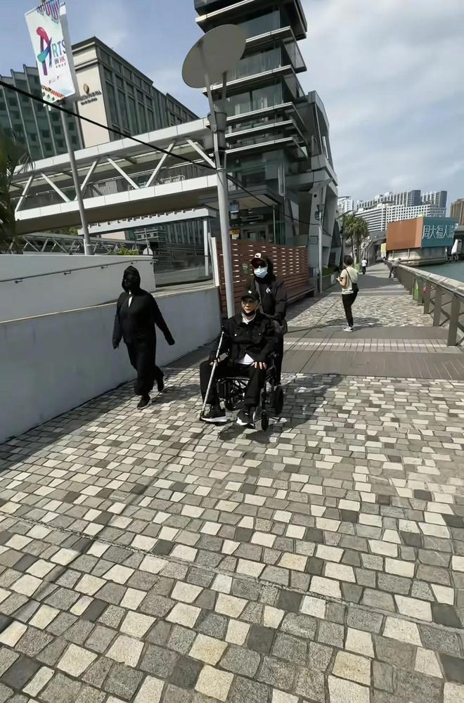 什么原因引起脸部浮肿_脸部浮肿原因_