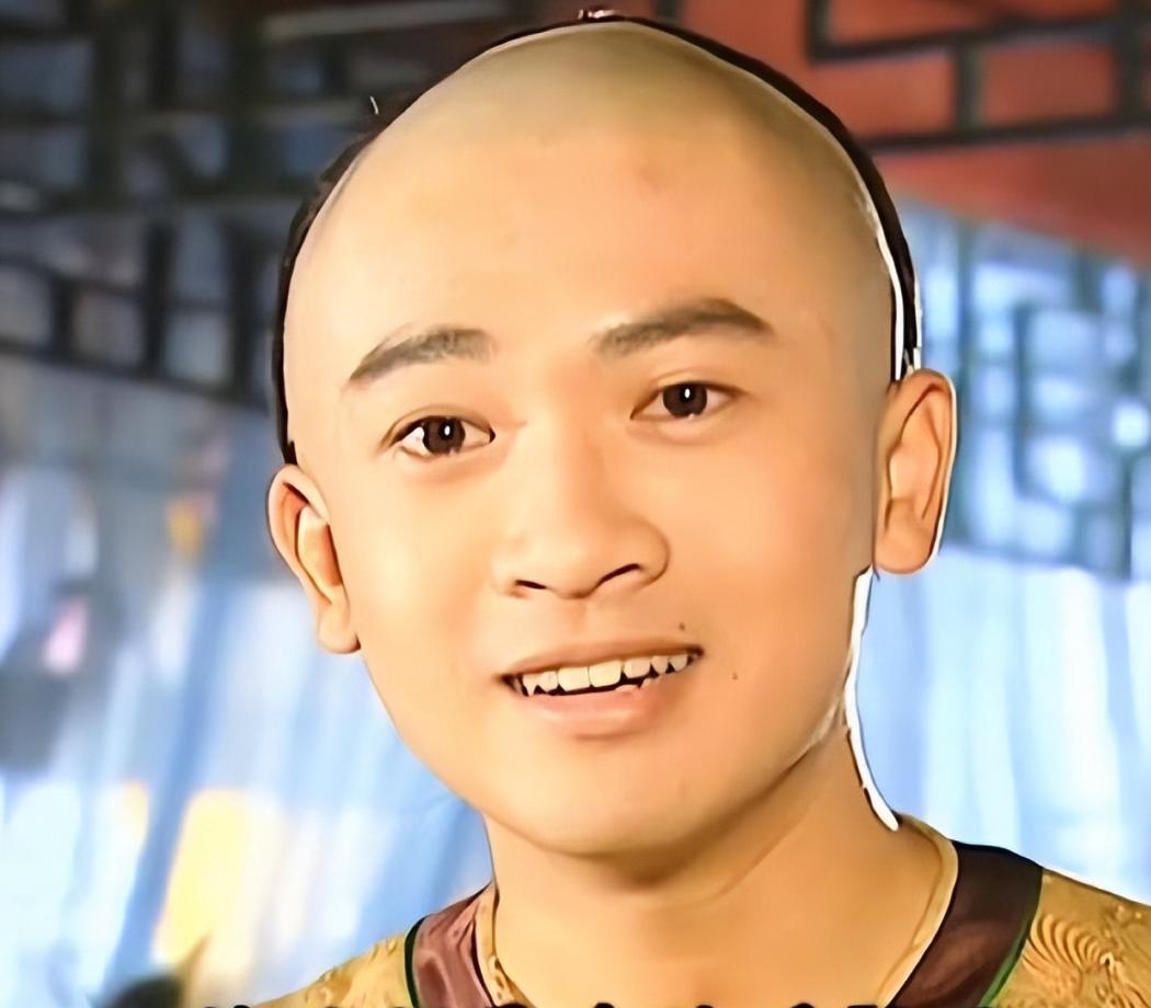 _苏有朋正容了吗_苏有朋颜值变化