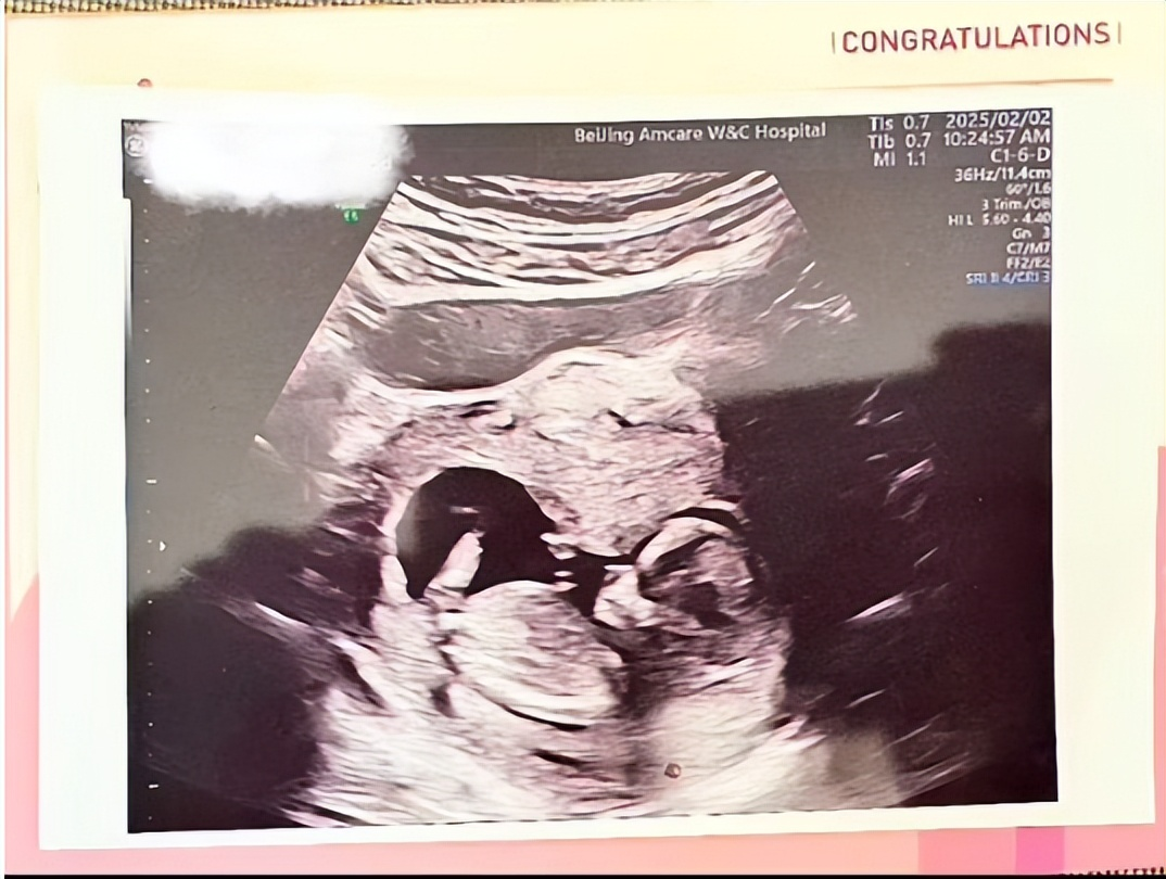 _发烧期间怀孕了有事吗_发烧怀孕的几率是多少